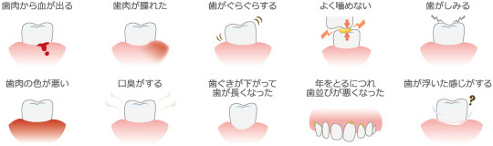 歯周病の症状のイラスト